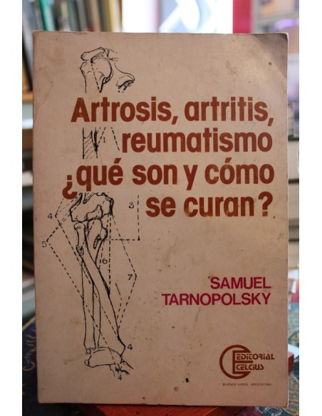 Artrosis, artritis, reumatismo ¿qué son y cómo se curan? (Usado) Artrosis, artritis, reumatismo ¿qué son y cómo se curan? (Usado)